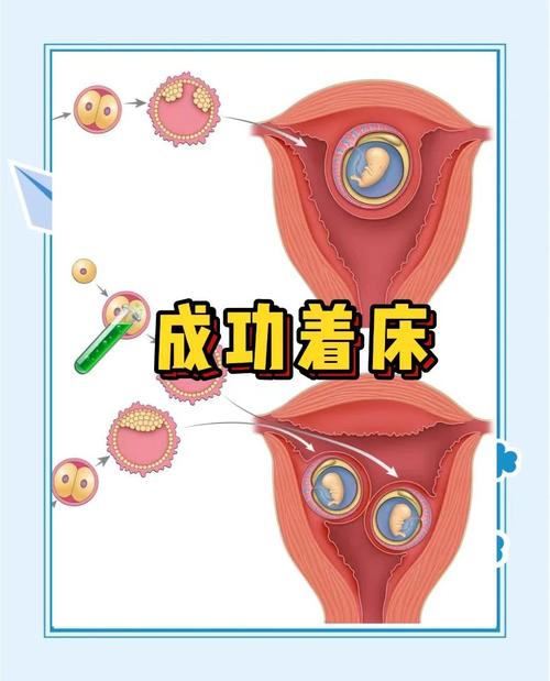 着床迹象