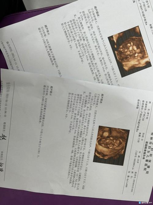 试管婴儿有心跳的具体表现和症状？