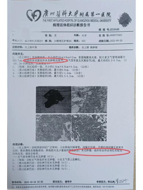 医院误配