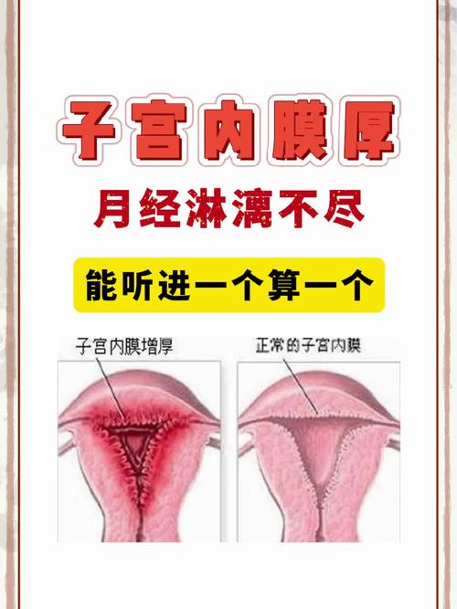 子宫内膜因素
