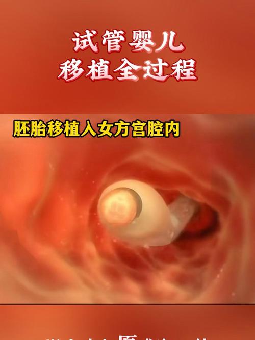 试管婴儿移植后会进入宫腔吗？