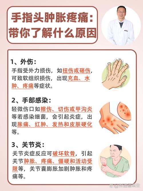 手肿原因