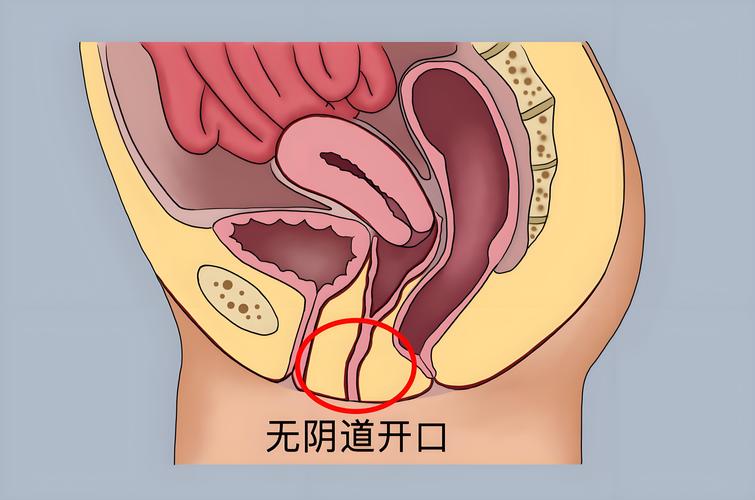 石女