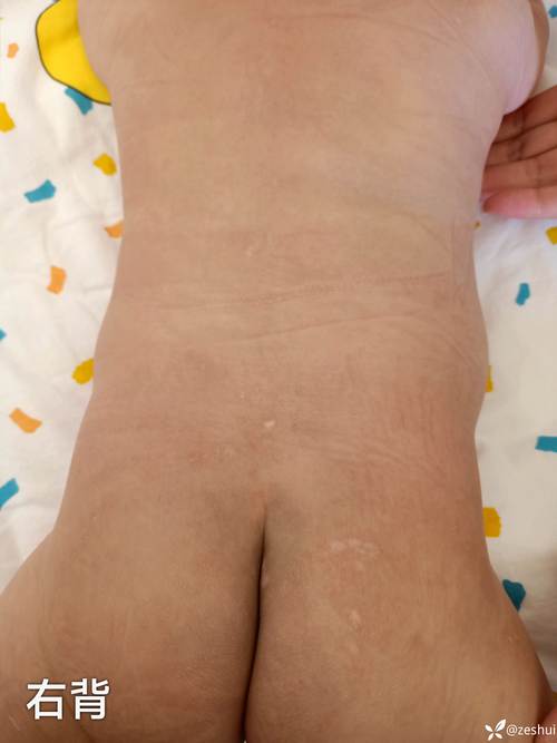 鲜胚发育不良