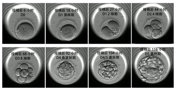 淮阳试管婴儿