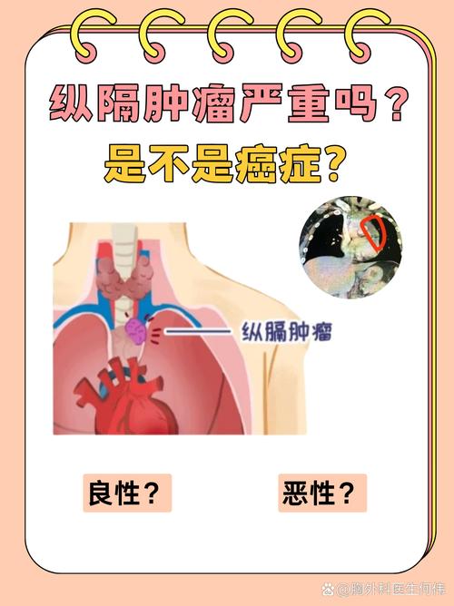纵隔肿瘤
