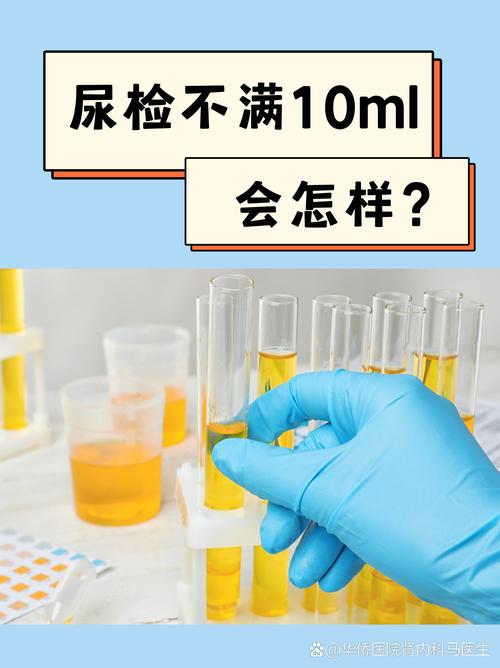 尿液检测