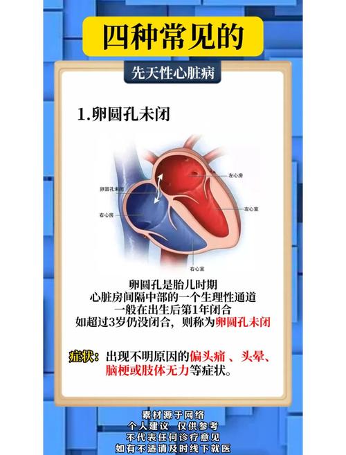  先天疾病