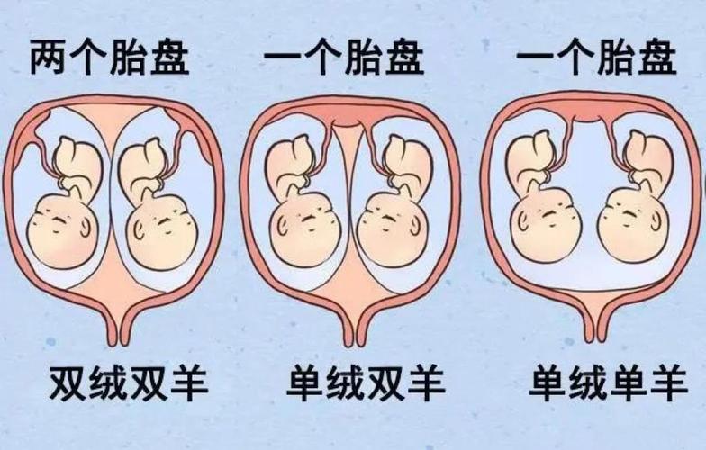  双胎率