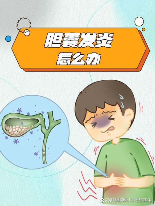 胆囊疾病