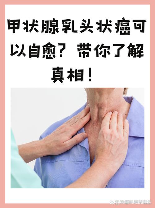 甲状腺乳状癌与试管婴儿的健康抉择