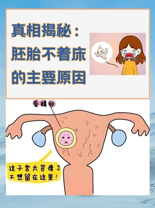 胚胎不着床