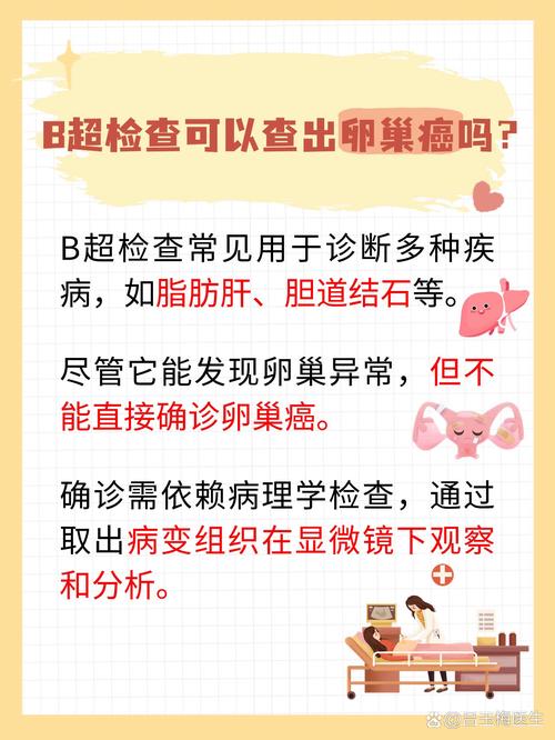 卵巢癌筛查
