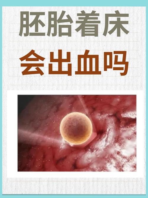 试管婴儿着床后是否会有出血现象？
