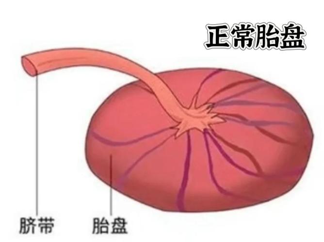  胎盘异常