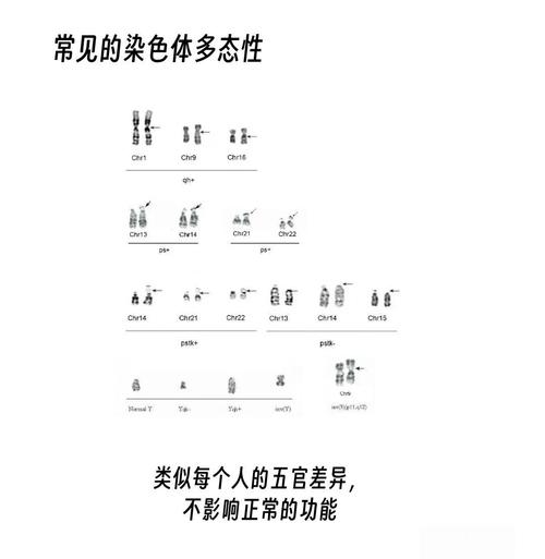 染色体因素