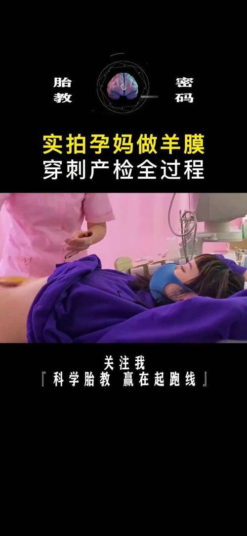 孕期穿刺检查