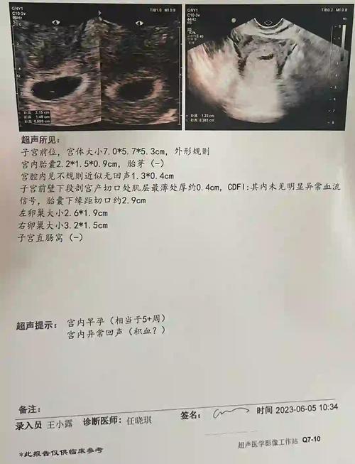 空孕囊发生率
