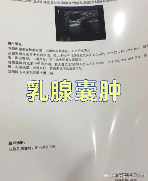  乳腺囊肿