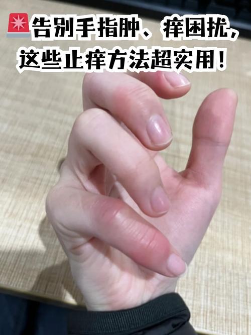 手肿处理办法