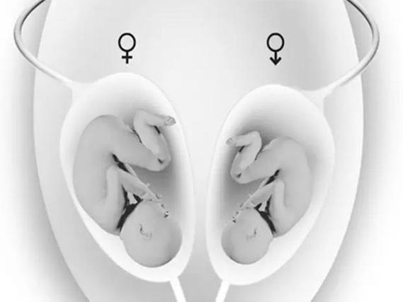 女性为何适合多胎试管婴儿？