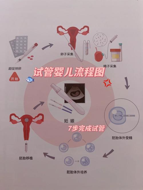 试管婴儿照顾方式