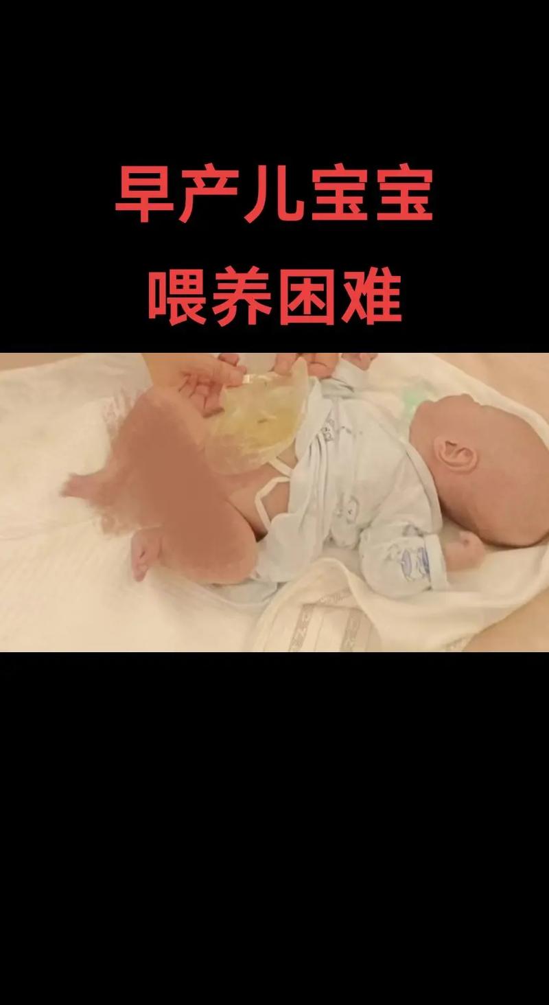 喂养困难