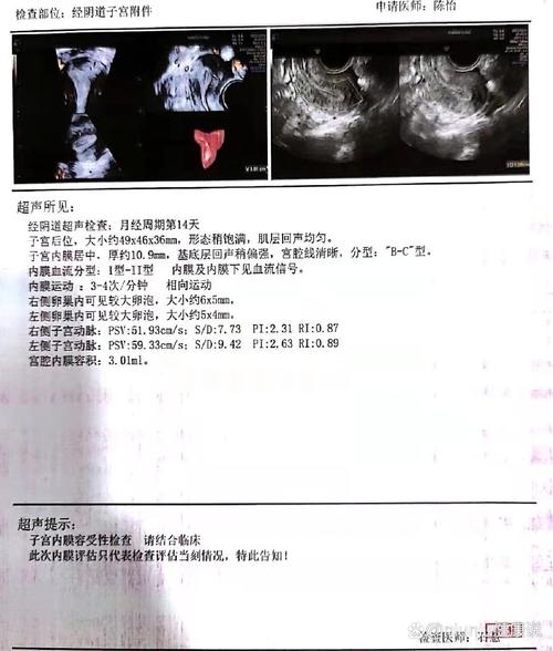 子宫内膜容受性检测