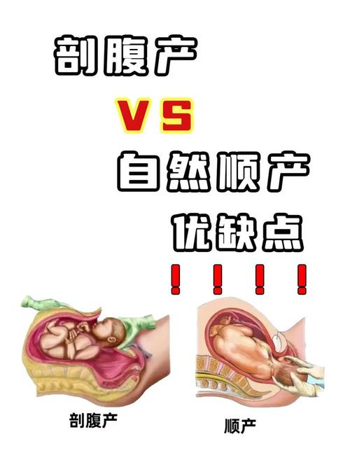 试管婴儿，究竟是顺产还是剖宫产？