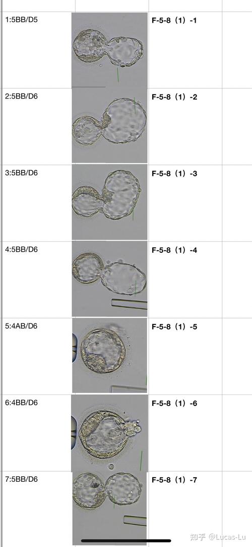 试管婴儿卵子评分3是什么意思？