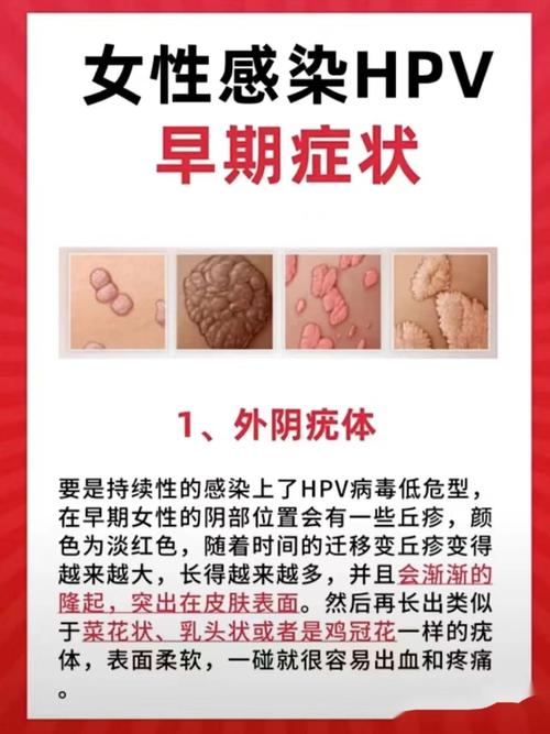 早期征兆