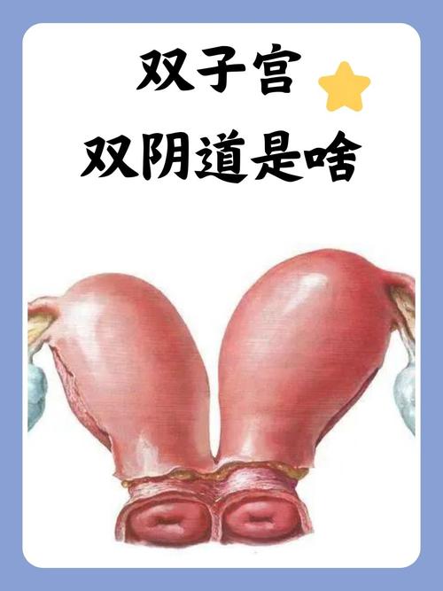 双子宫