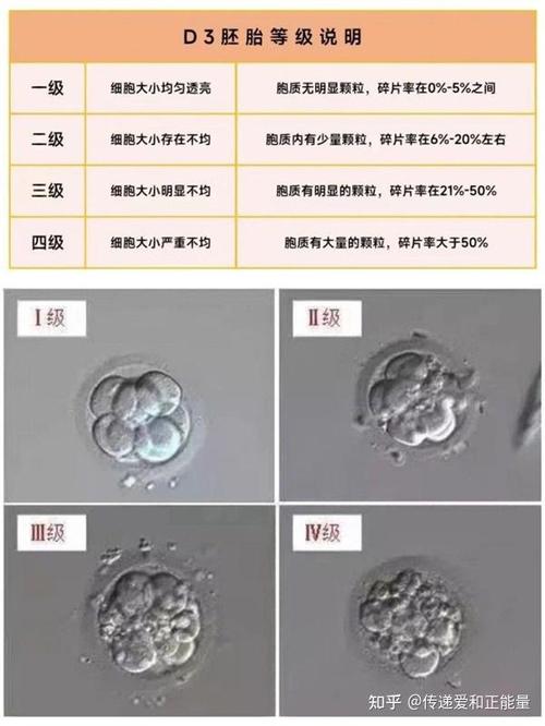 为什么试管婴儿也有不能做的原因？