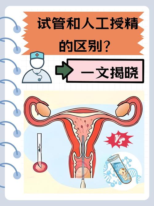 试管授精