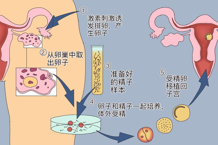 做试管婴儿是否真的需要输卵管？