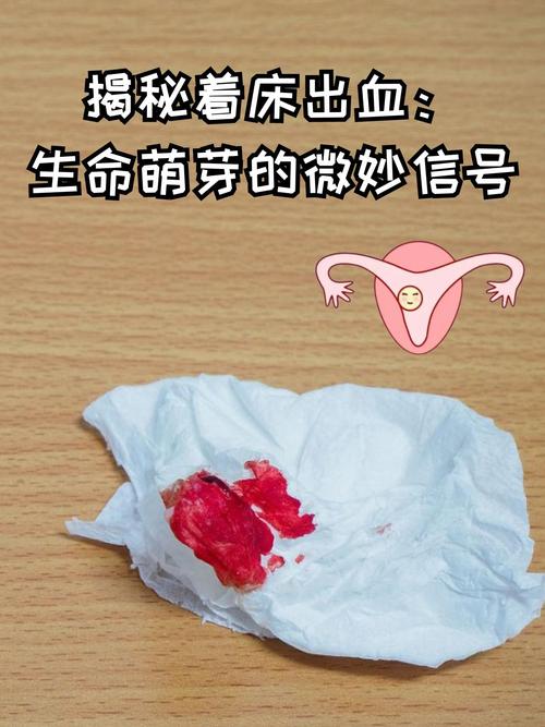 着床后出血