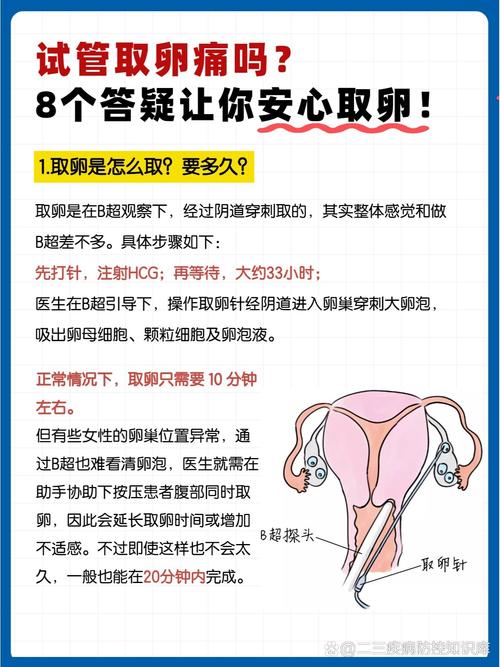 试管婴儿取卵疼痛如何缓解？