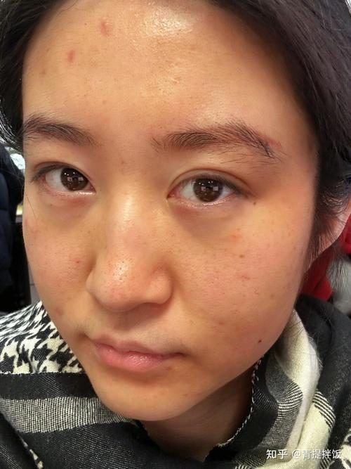 女性脸色差
