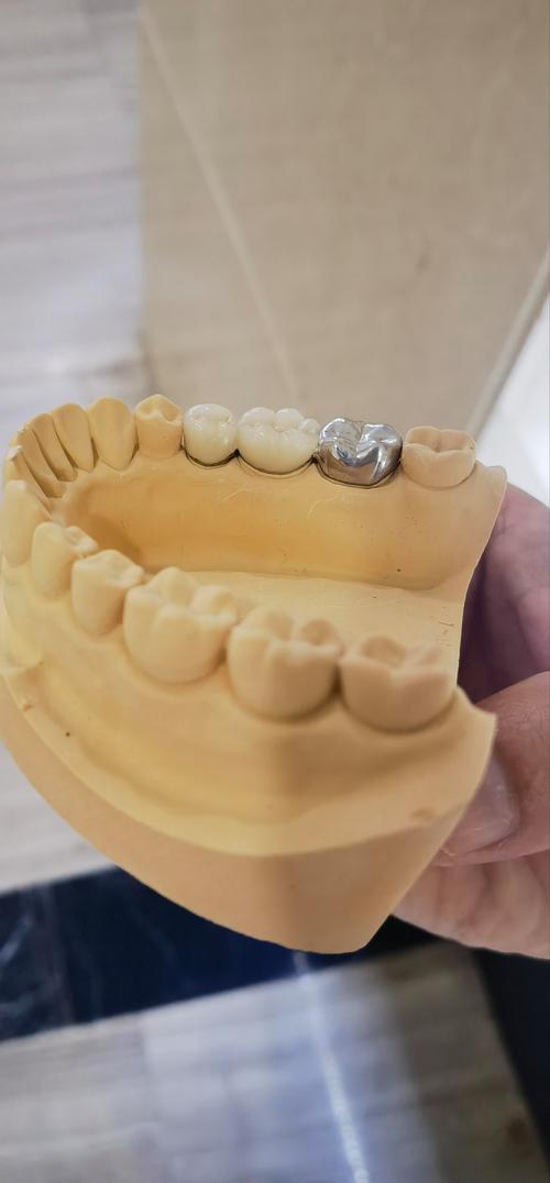 试管婴儿技术能修复牙齿缺陷吗？