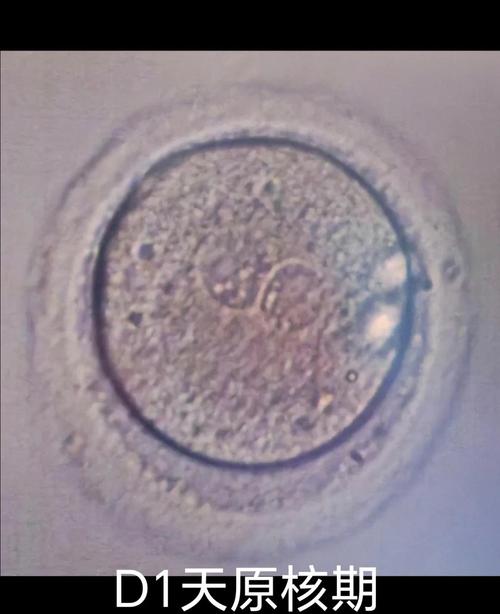不活动精子能成功试管婴儿吗？