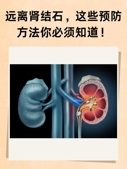  避免方法